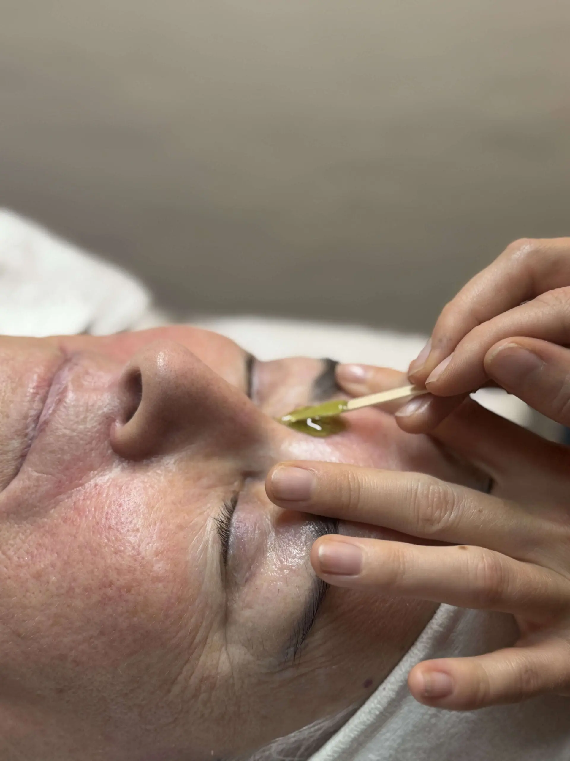 Voksbehandling hos Klinik Majland, ansigtsbehandling i Odense